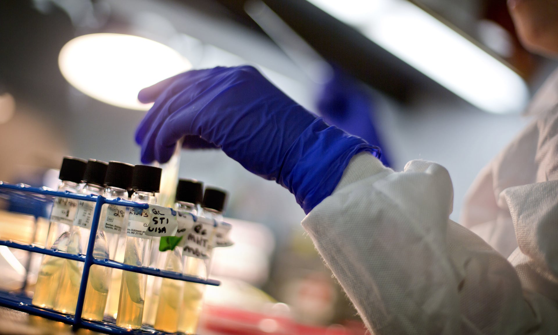 ‘Superbugs’ a far greater risk than Covid in Pacific